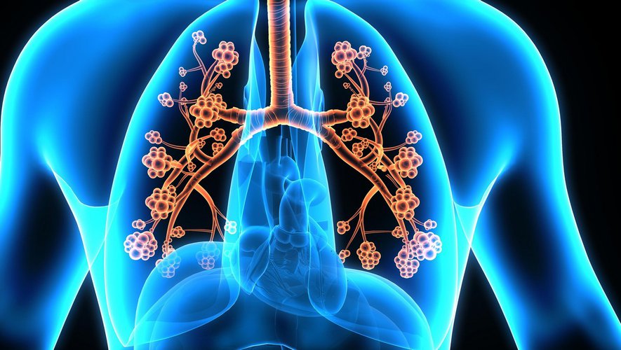 L’asthme allergique : tout ce qu’il y a à savoir